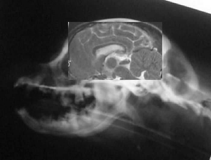 Andy skull xray with brain MRI