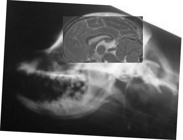 Finley skull xray with brain MRI