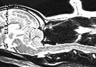 Side skull xray and MRI MCER