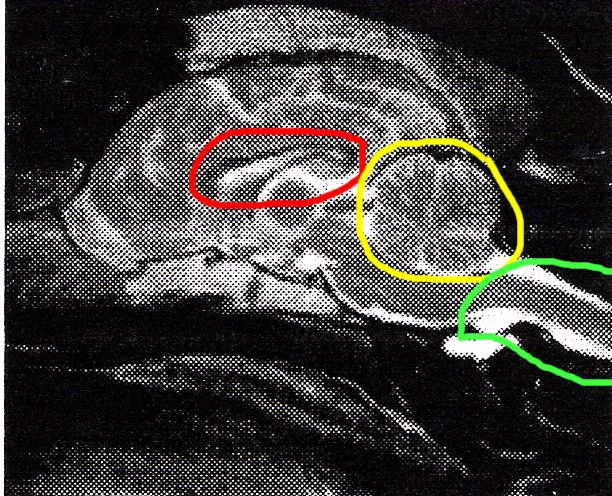 Normal MRI Dalmation pic