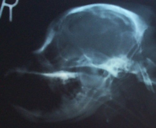 Side skull xray MCER